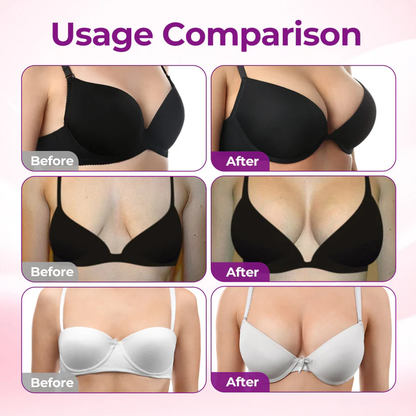 Alvensa®Targeted Breast Enhancement Advanced Nano Microneedle Patch