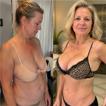 Alvensa®Targeted Breast Enhancement Advanced Nano Microneedle Patch