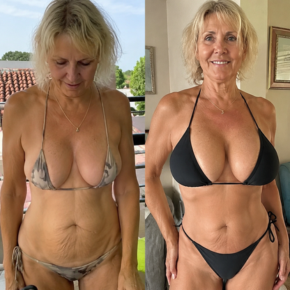Alvensa®Targeted Breast Enhancement Advanced Nano Microneedle Patch